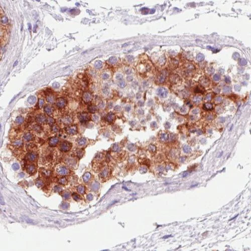 Immunohistochemistry (Formalin/PFA-fixed paraffin-embedded sections) - Anti-P4HA2 antibody [CL0351] (AB211527)