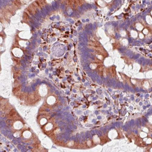 Immunohistochemistry (Formalin/PFA-fixed paraffin-embedded sections) - Anti-P4HA2 antibody [CL0351] (AB211527)