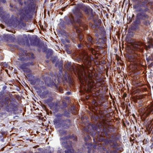 Immunohistochemistry (Formalin/PFA-fixed paraffin-embedded sections) - Anti-P4HA2 antibody [CL0351] (AB211527)