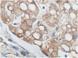 Immunohistochemistry (Formalin/PFA-fixed paraffin-embedded sections) - Anti-P4HA3 antibody (AB101657), expandable thumbnail