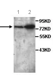 Western blot - Anti-P4HA3 antibody (AB101657)