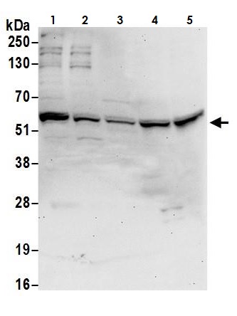 Western blot - Anti-P4HB antibody (AB264363)