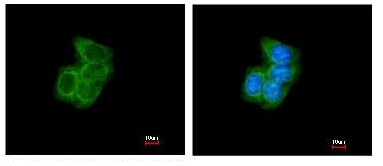 Immunocytochemistry/ Immunofluorescence - Anti-P4HB antibody (AB96744), expandable thumbnail