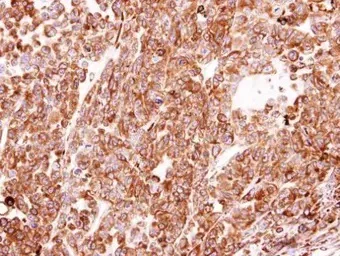 Immunohistochemistry (Formalin/PFA-fixed paraffin-embedded sections) - Anti-P4HB antibody (AB96744)