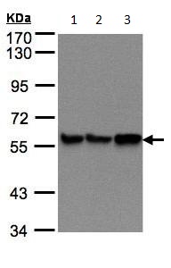 Western blot - Anti-P4HB antibody (AB96744), expandable thumbnail