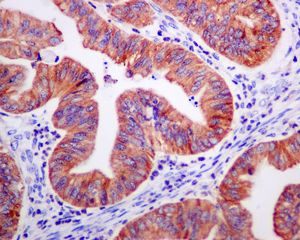 Immunohistochemistry (Formalin/PFA-fixed paraffin-embedded sections) - Anti-P4HB antibody [EPR9498] - BSA and Azide free (AB248832), expandable thumbnail