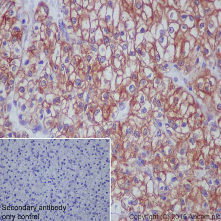 Immunohistochemistry (Formalin/PFA-fixed paraffin-embedded sections) - Anti-P4HB antibody [EPR9499] (AB137110)