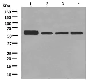 Western blot - Anti-P4HB antibody [EPR9499] (AB137110)