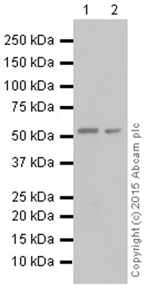 Western blot - Anti-P4HB antibody [EPR9499] (AB137110)