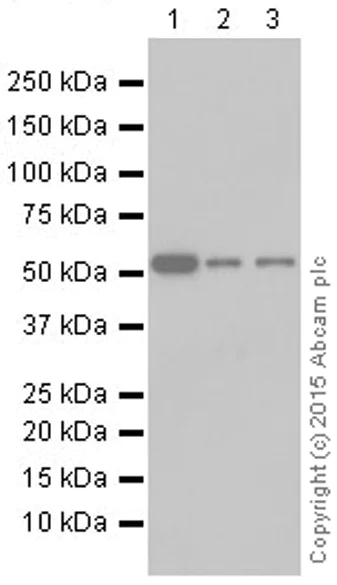 Western blot - Anti-P4HB antibody [EPR9499] (AB137110)