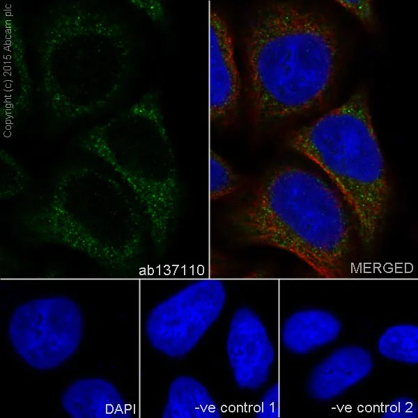 Immunocytochemistry/ Immunofluorescence - Anti-P4HB antibody [EPR9499] - BSA and Azide free (AB232347)