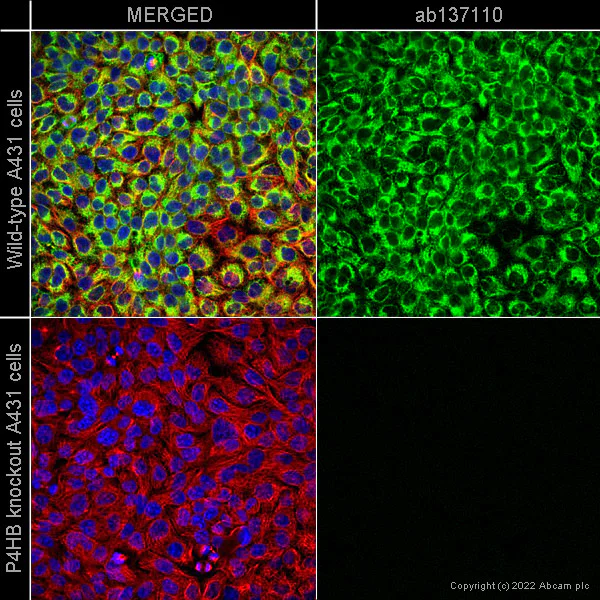 Immunocytochemistry/ Immunofluorescence - Anti-P4HB antibody [EPR9499] - BSA and Azide free (AB232347)