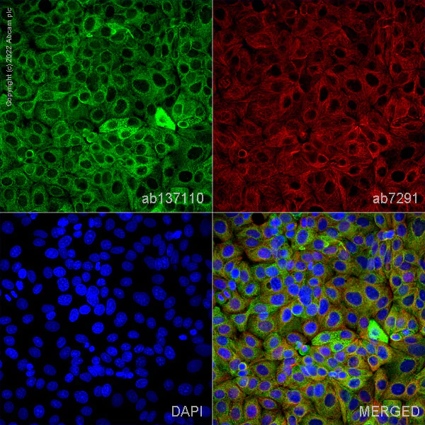 Immunocytochemistry/ Immunofluorescence - Anti-P4HB antibody [EPR9499] - BSA and Azide free (AB232347)