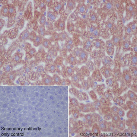 Immunohistochemistry (Formalin/PFA-fixed paraffin-embedded sections) - Anti-P4HB antibody [EPR9499] - BSA and Azide free (AB232347)