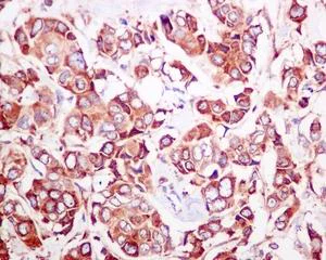 Immunohistochemistry (Formalin/PFA-fixed paraffin-embedded sections) - Anti-P4HB antibody [EPR9499] - BSA and Azide free (AB232347)