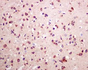 Immunohistochemistry (Formalin/PFA-fixed paraffin-embedded sections) - Anti-P4HB antibody [EPR9499] - BSA and Azide free (AB232347)