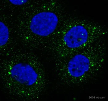 Anti-P4HB antibody [RL90] (ab2792) | Abcam