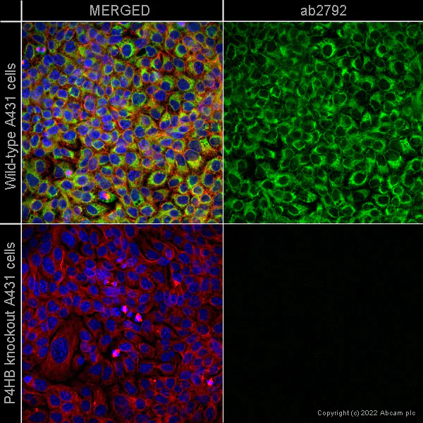Immunocytochemistry/ Immunofluorescence - Anti-P4HB antibody [RL90] (AB2792)