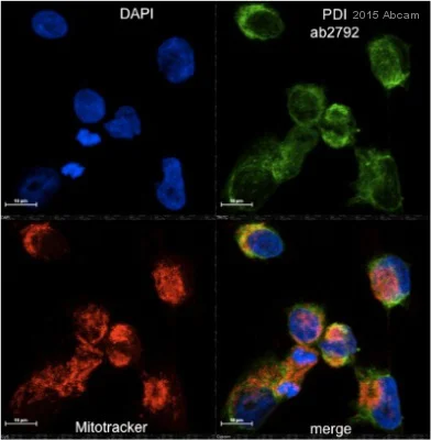 Immunocytochemistry/ Immunofluorescence - Anti-P4HB antibody [RL90] (AB2792)