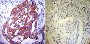 Immunohistochemistry (Formalin/PFA-fixed paraffin-embedded sections) - Anti-P4HB antibody [RL90] (AB2792)