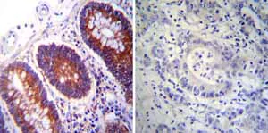 Immunohistochemistry (Formalin/PFA-fixed paraffin-embedded sections) - Anti-P4HB antibody [RL90] (AB2792)
