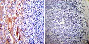 Immunohistochemistry (Formalin/PFA-fixed paraffin-embedded sections) - Anti-P4HB antibody [RL90] (AB2792)