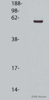 Western blot - Anti-P4HB antibody [RL90] (AB2792)
