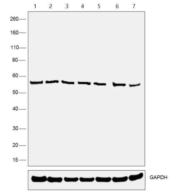 Western blot - Anti-P4HB antibody [RL90] (AB2792)