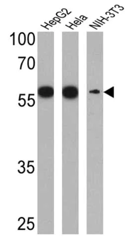 Western blot - Anti-P4HB antibody [RL90] (AB2792)