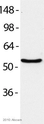 Western blot - Anti-P4HB antibody [RL90] (AB2792)