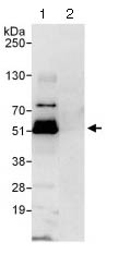 Immunoprecipitation - Anti-p50 dynamitin antibody (AB124285)