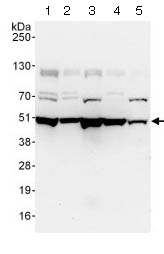Western blot - Anti-p50 dynamitin antibody (AB124285)