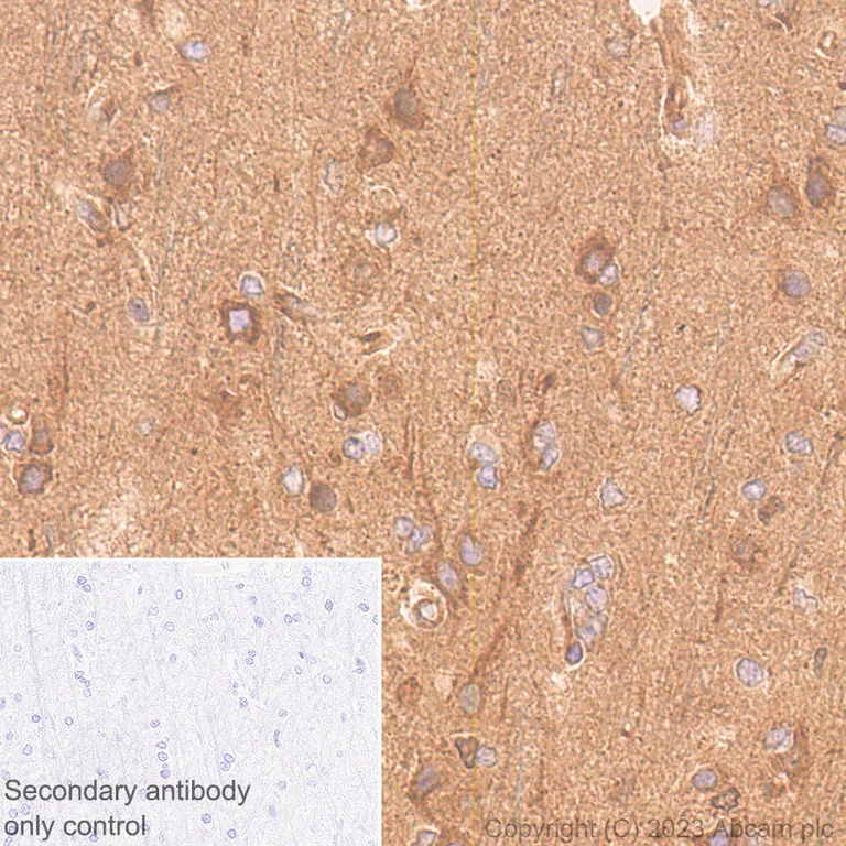 Immunohistochemistry (Formalin/PFA-fixed paraffin-embedded sections) - Anti-p50 dynamitin antibody [EPR5095] (AB133492)