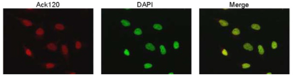 Immunocytochemistry/ Immunofluorescence - Anti-p53 (acetyl K120) antibody [10E5] (AB78316), expandable thumbnail