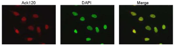 Immunocytochemistry/ Immunofluorescence - Anti-p53 (acetyl K120) antibody [10E5] (AB78316)