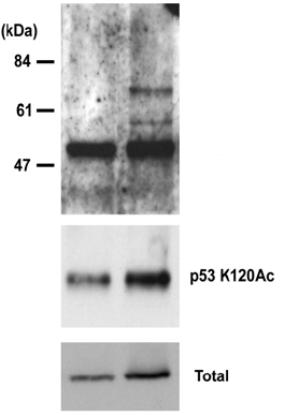 Western blot - Anti-p53 (acetyl K120) antibody [10E5] (AB78316), expandable thumbnail