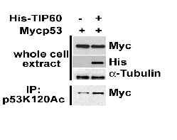 Western blot - Anti-p53 (acetyl K120) antibody [10E5] (AB78316)