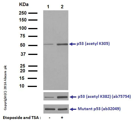 Western blot - Anti-p53 (acetyl K305) antibody [EPR354(3)] - BSA and Azide free (AB226063)