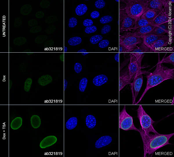 Immunocytochemistry/ Immunofluorescence - Anti-p53 (acetyl K305 + K370 + K373) antibody [RM1200] (AB321819)