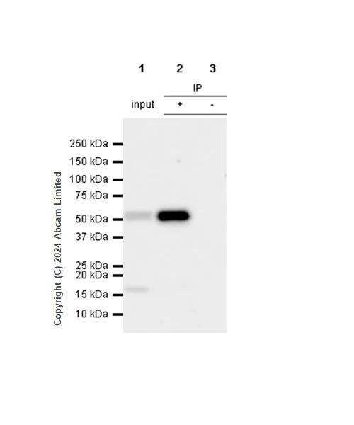 Immunoprecipitation - Anti-p53 (acetyl K305 + K370 + K373) antibody [RM1200] (AB321819)