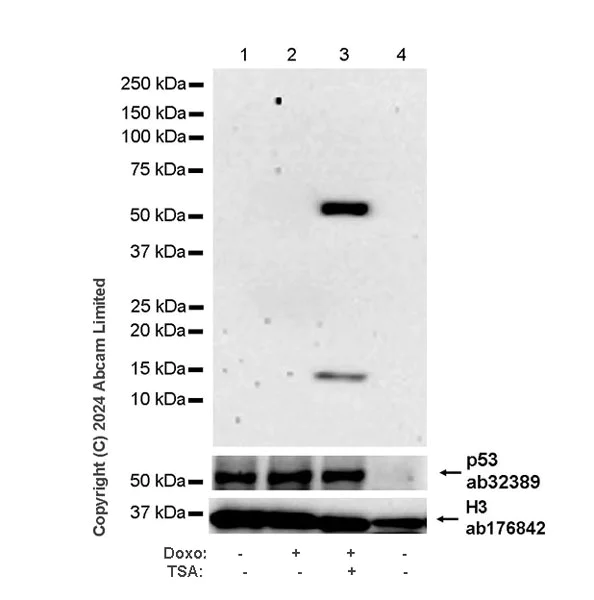 Western blot - Anti-p53 (acetyl K305 + K370 + K373) antibody [RM1200] (AB321819)