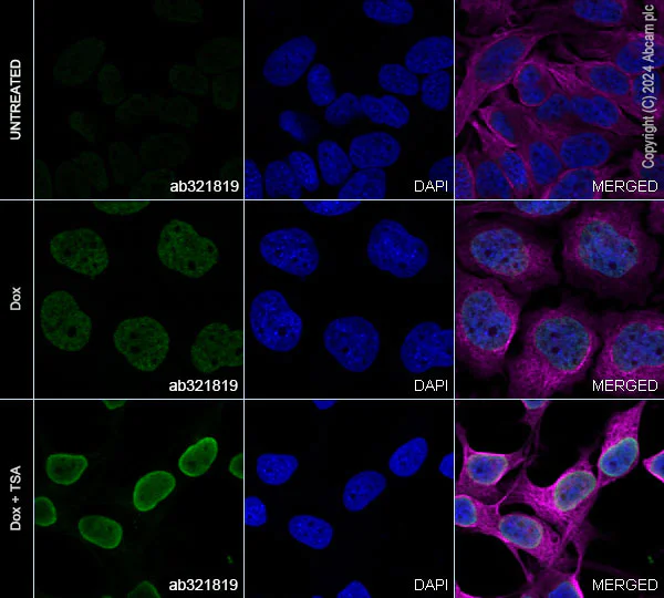 Immunocytochemistry/ Immunofluorescence - Anti-p53 (acetyl K305 + K370 + K373) antibody [RM1200] - BSA and Azide free (AB321820)