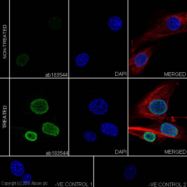 Immunocytochemistry/ Immunofluorescence - Anti-p53 (acetyl K370) antibody [EPR17496] (AB183544), expandable thumbnail