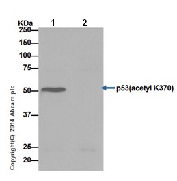 Immunoprecipitation - Anti-p53 (acetyl K370) antibody [EPR17496] (AB183544), expandable thumbnail