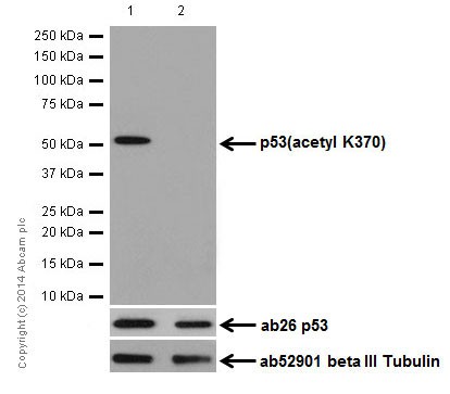 Western blot - Anti-p53 (acetyl K370) antibody [EPR17496] (AB183544), expandable thumbnail