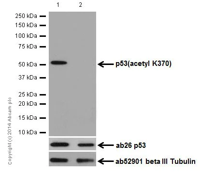 Western blot - Anti-p53 (acetyl K370) antibody [EPR17496] (AB183544)