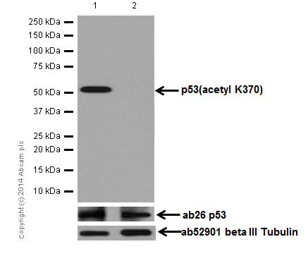 Western blot - Anti-p53 (acetyl K370) antibody [EPR17496] (AB183544), expandable thumbnail