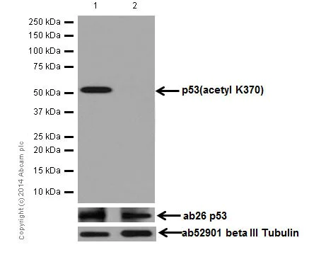 Western blot - Anti-p53 (acetyl K370) antibody [EPR17496] (AB183544)