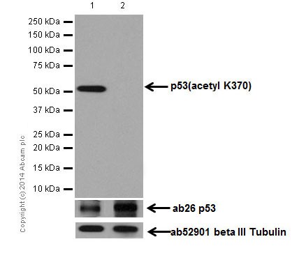 Western blot - Anti-p53 (acetyl K370) antibody [EPR17496] (ab183544), expandable thumbnail