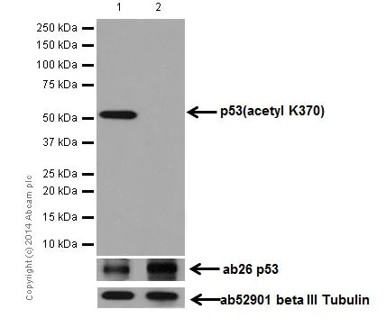 Western blot - Anti-p53 (acetyl K370) antibody [EPR17496] (AB183544)